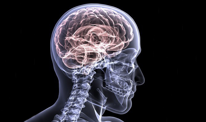 Röntgenfoto van het menselijk brein 